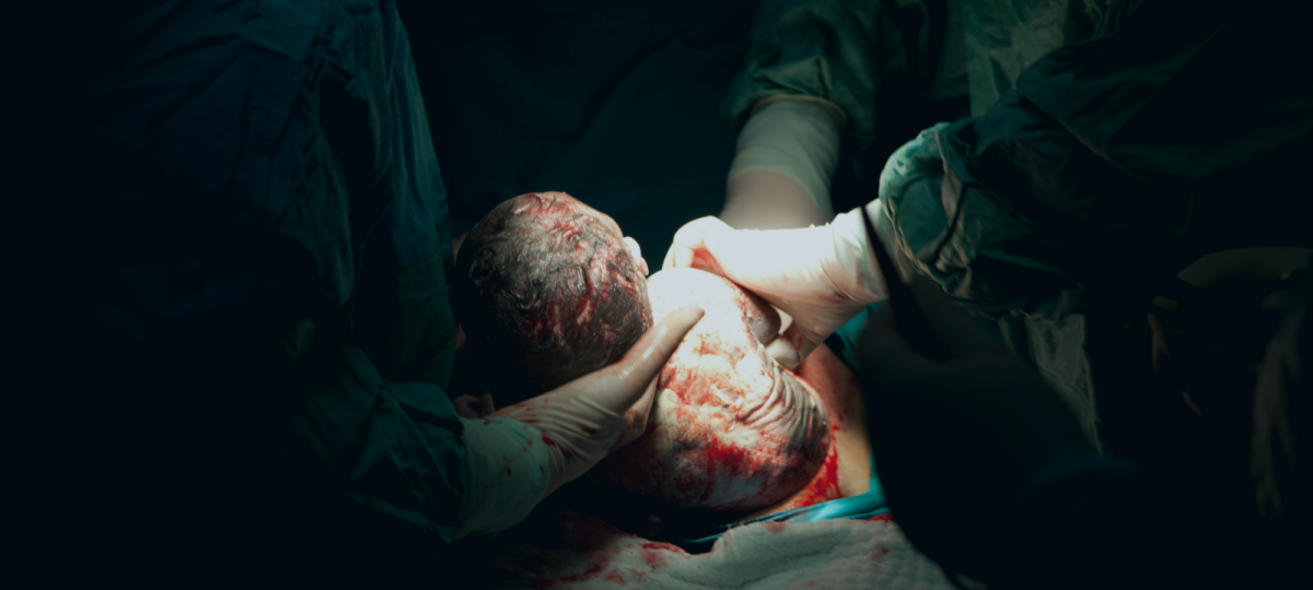 cesarean section - uterine rupture birth injury attorney