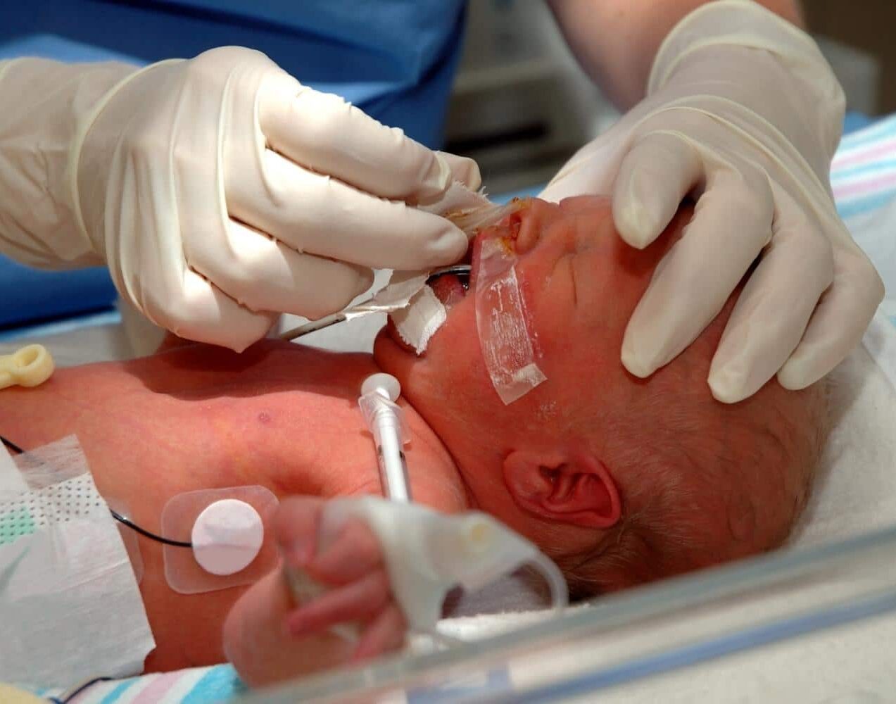 newborn seizure attorney in cincinnati ohio