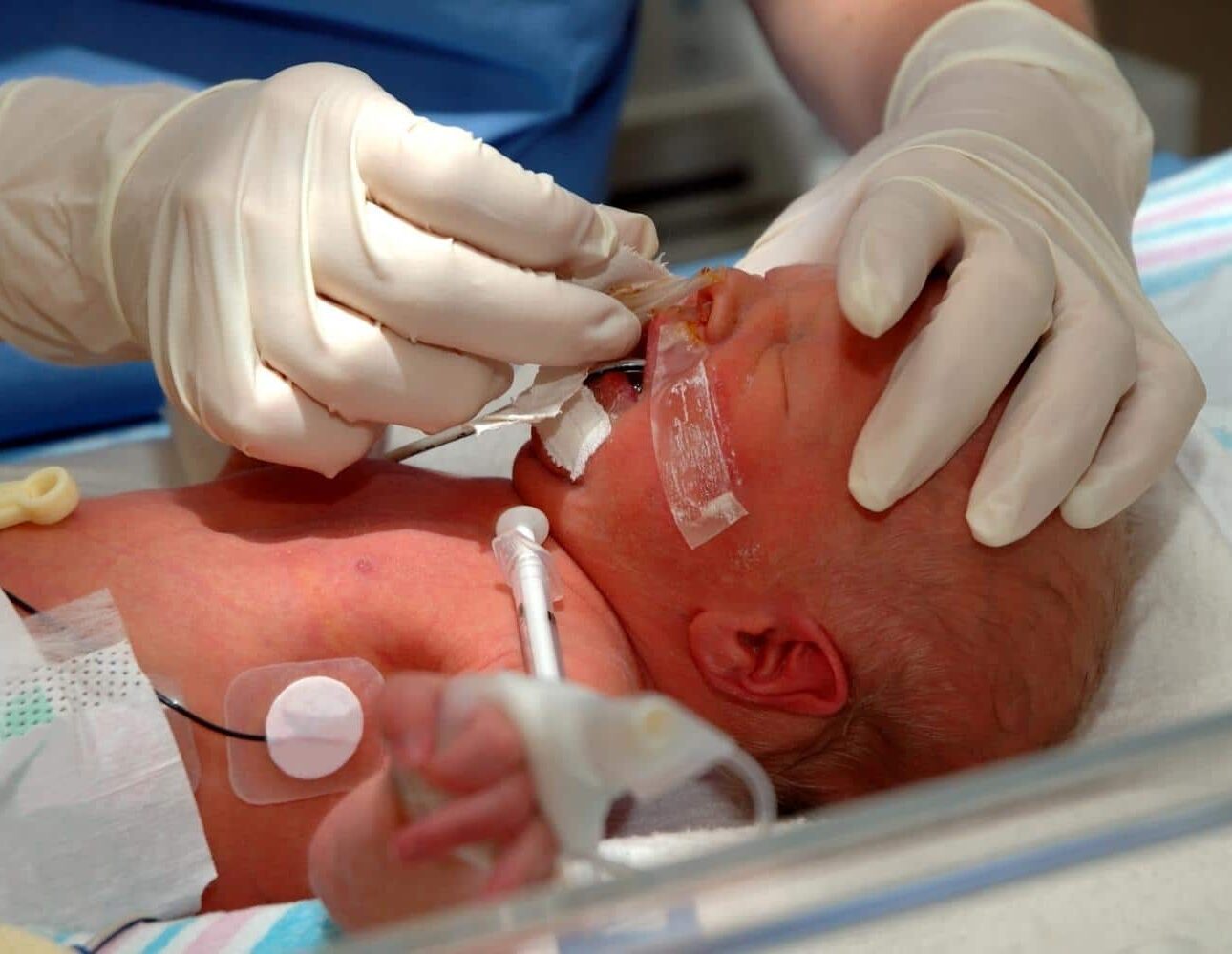 newborn seizure attorney in cincinnati ohio
