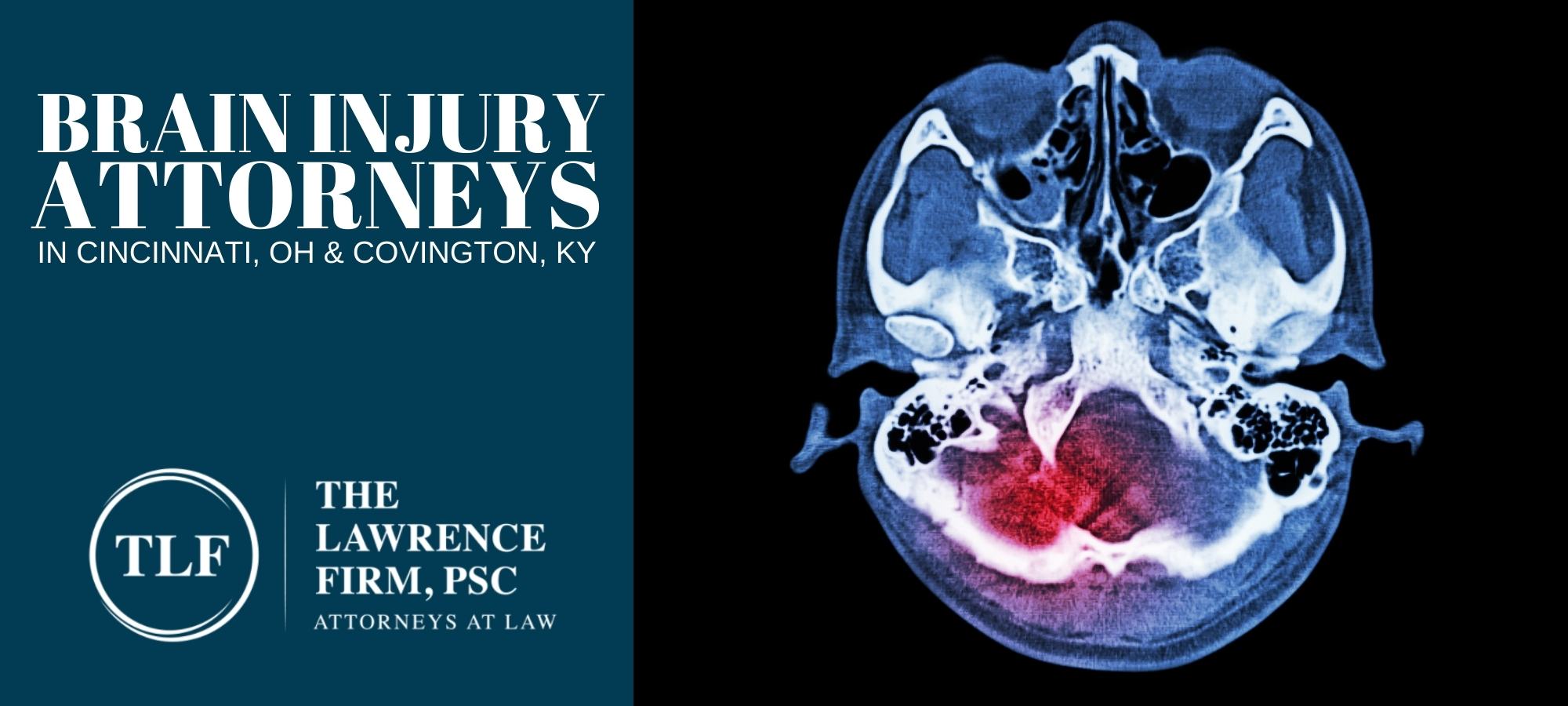 Kentucky Traumatic Brain Injury Lawyers