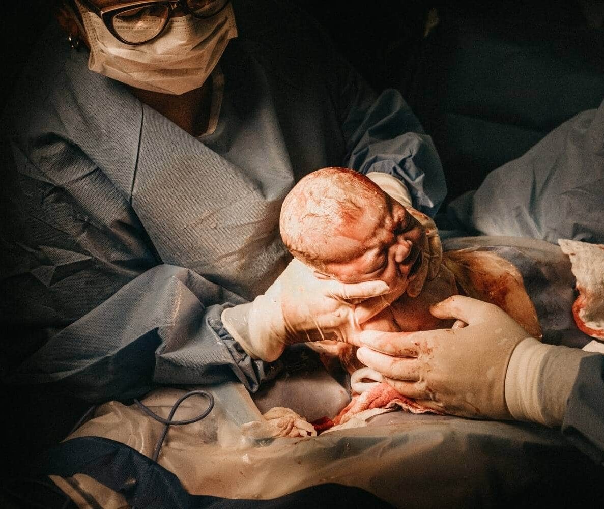 c section medical malpractice claim