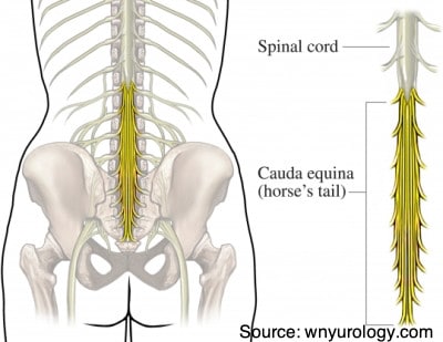 Cauda equina