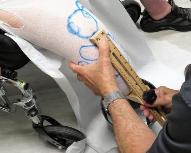 Cincinnati Traumatic Amputation Injury Lawyer