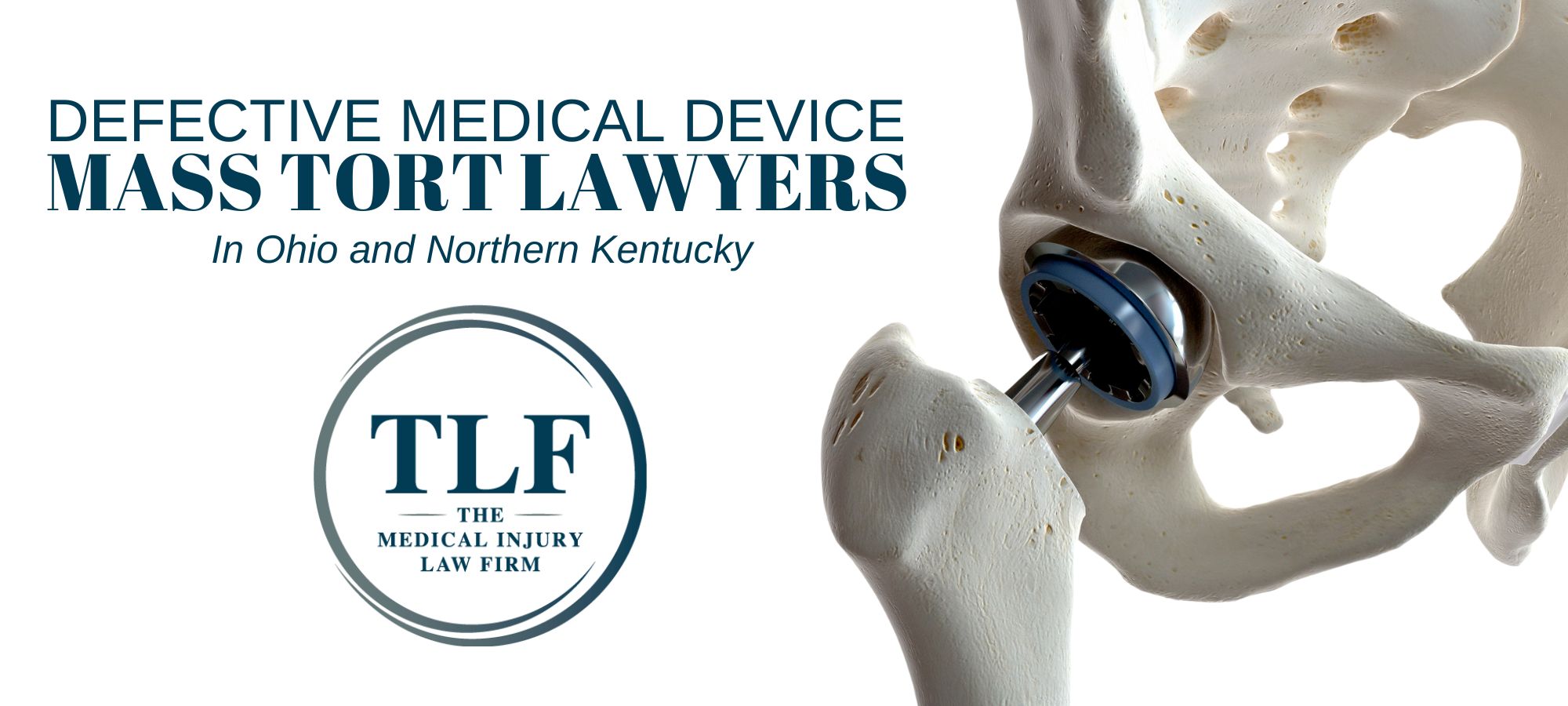 Defective Medical Device Mass Tort Lawyer