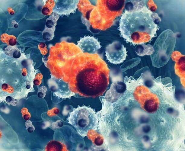 Cancer Misdiagnosis Attorneys in Kentucky and Ohio