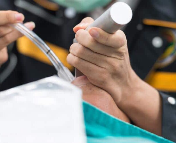 Intubation Injury Attorney in Kentucky
