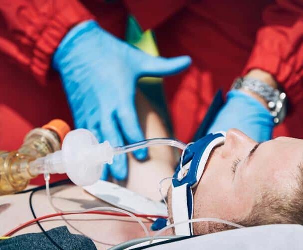 Intubation Injury Attorneys in Kentucky and Ohio