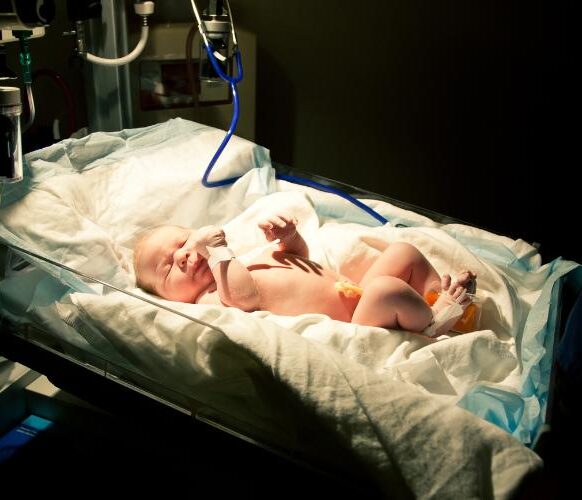 Placental Abruption Attorney