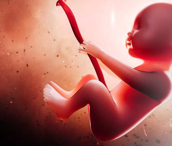 Placental Abruption Birth Injury Lawyers