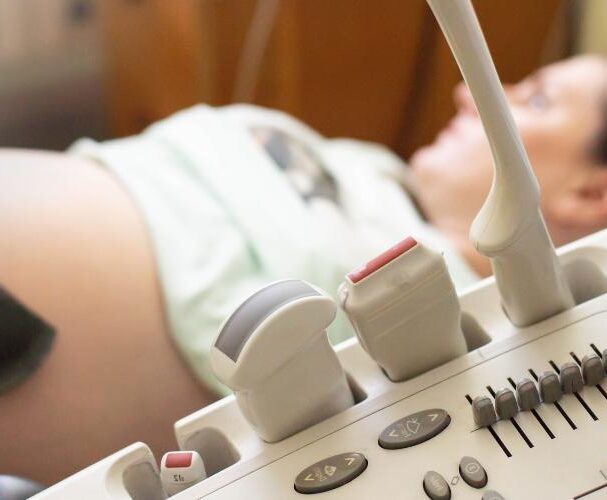 What is Placental Abruption