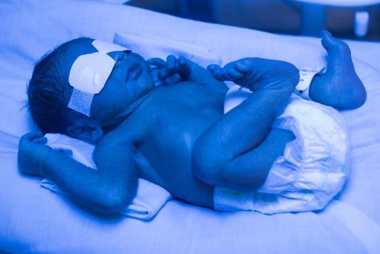 Failure to Diagnose Jaundice Medical Malpractice