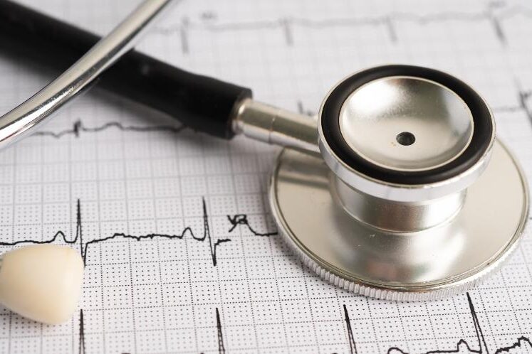 What are Heart Arrhythmias