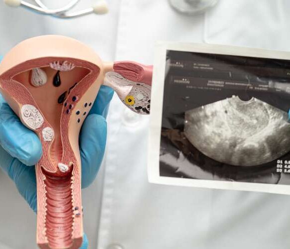 Uterine Rupture Lawyer