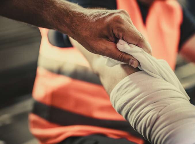 Kentucky Burn Injury Attorney