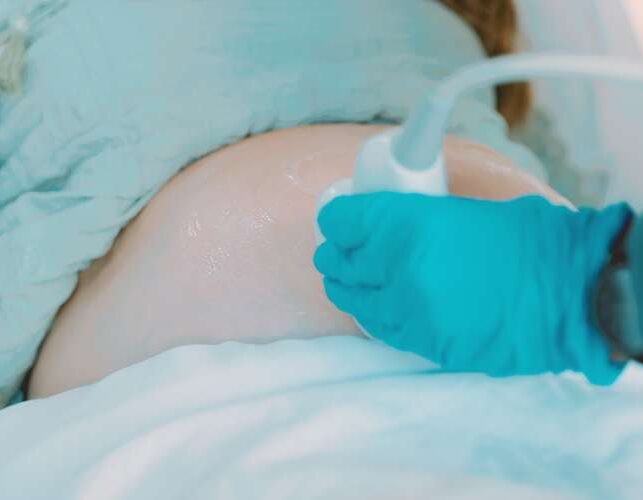 Stillbirth Compensation Claim