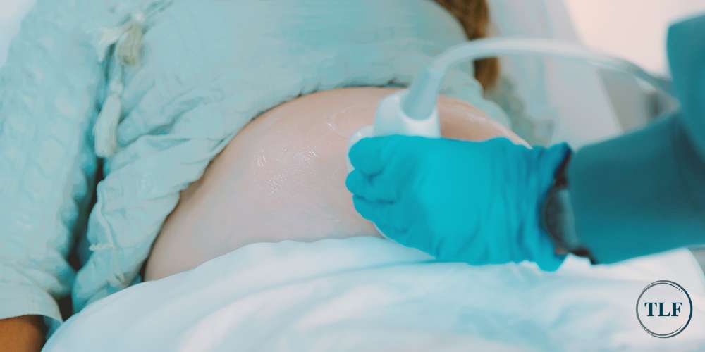 Stillbirth Compensation Claim
