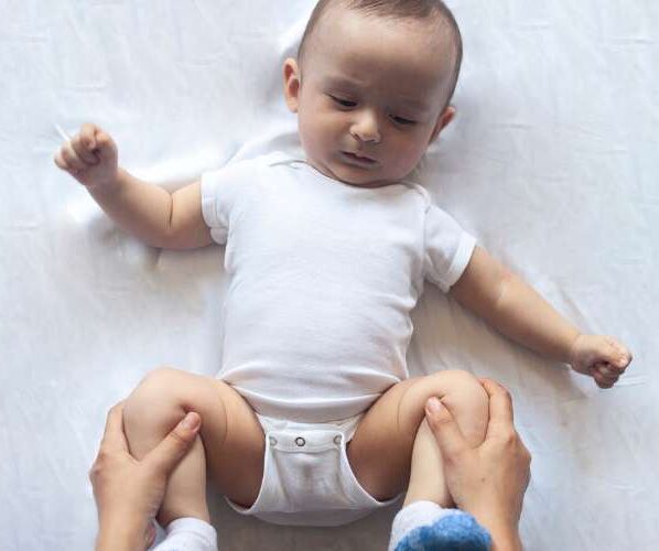 cervical dystonia in infants