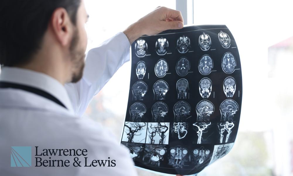 Cincinnati & Northern Kentucky Brain Injury Lawyer