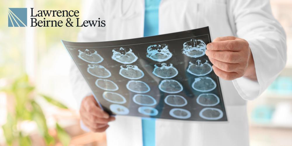 Neurology Malpractice attorney Ohio and Kentucky