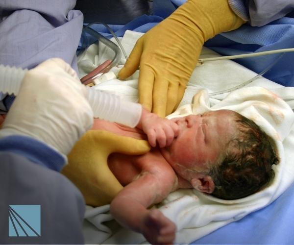 covington neonatal medical malpractice lawyer